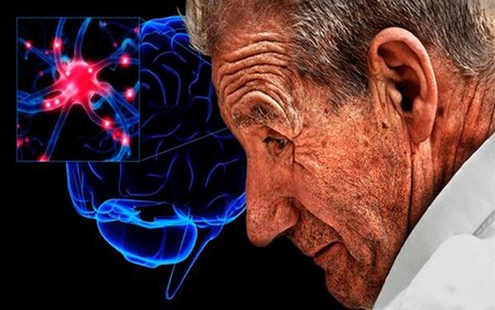Prevención del Parkinson a través de la alimentación