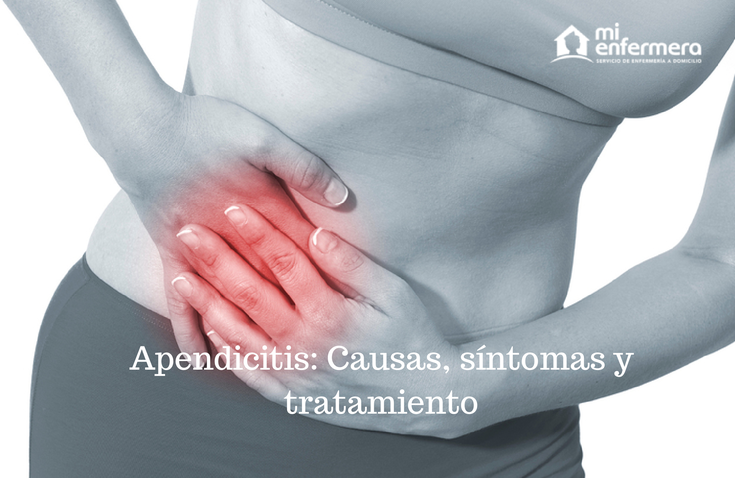 Apendicitis: causas síntomas y tratamiento